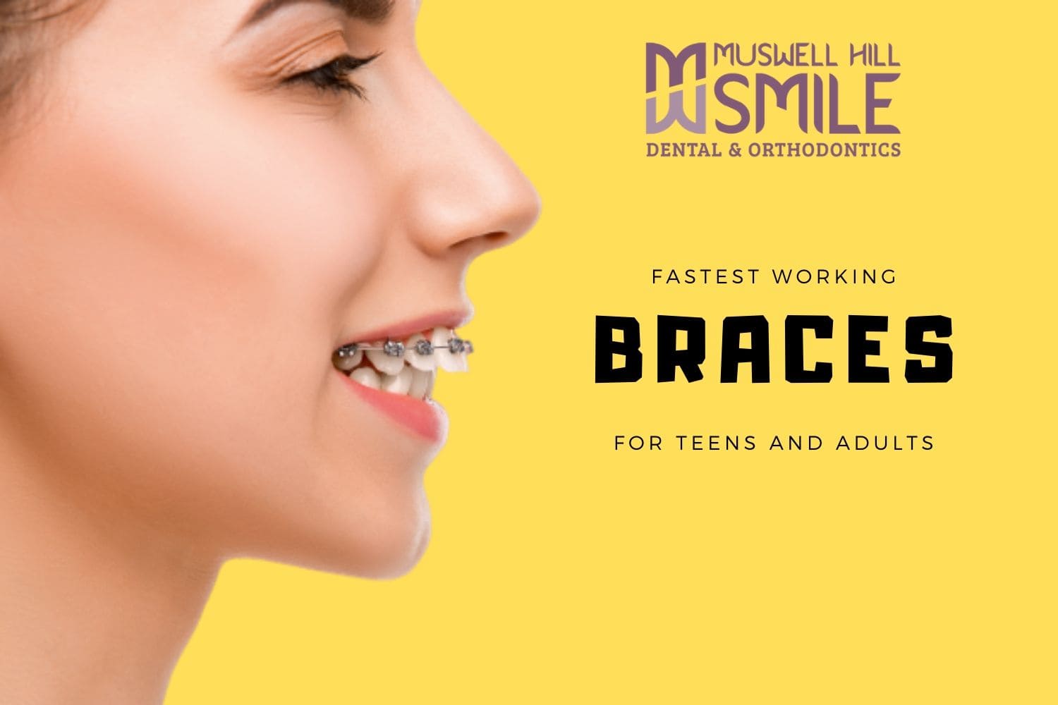 Metal braces London  Orthodontics in London